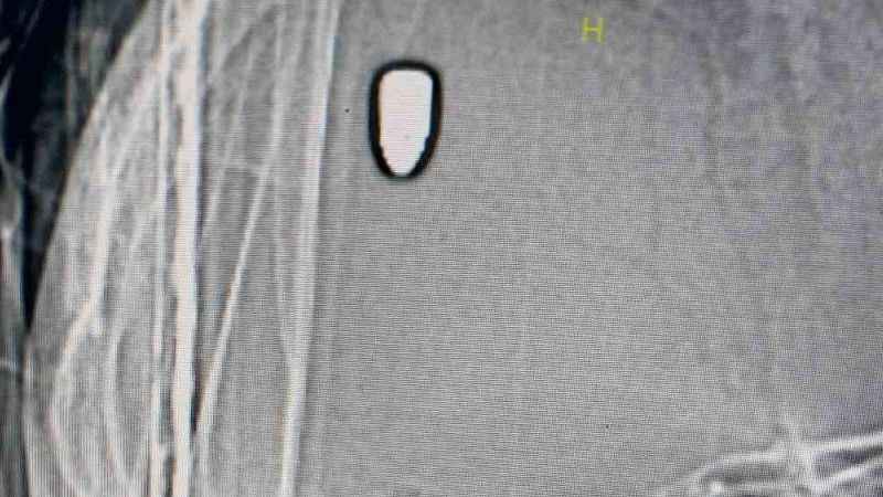 Arkadaşını beklerken kafasına yorgun mermi isabet etti Arkadaşını beklerken kafasına yorgun mermi isabet etti