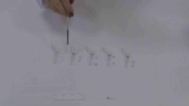 Genç girişimciler ‘Diş Çürükleri Erken Tanı Kiti’ projesini hayata geçirmeyi hedefliyor Genç girişimciler ‘Diş Çürükleri Erken Tanı Kiti’ projesini hayata geçirmeyi hedefliyor