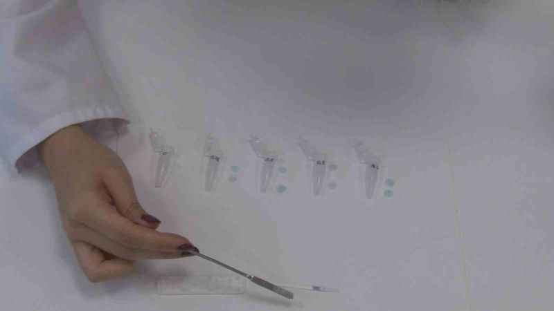 Genç girişimciler ‘Diş Çürükleri Erken Tanı Kiti’ projesini hayata geçirmeyi hedefliyor Genç girişimciler ‘Diş Çürükleri Erken Tanı Kiti’ projesini hayata geçirmeyi hedefliyor