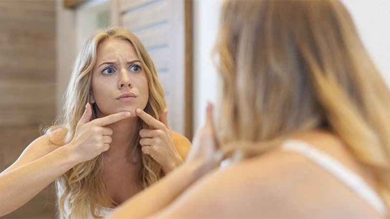 Sivilce sadece ergenlerin sorunu değil Sivilce sadece ergenlerin sorunu değil