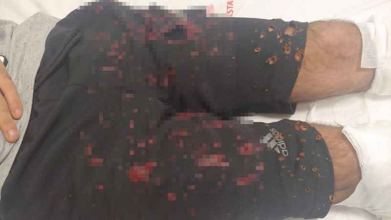 Lavabo açıcı 21 yaşındaki gence dehşeti yaşattı