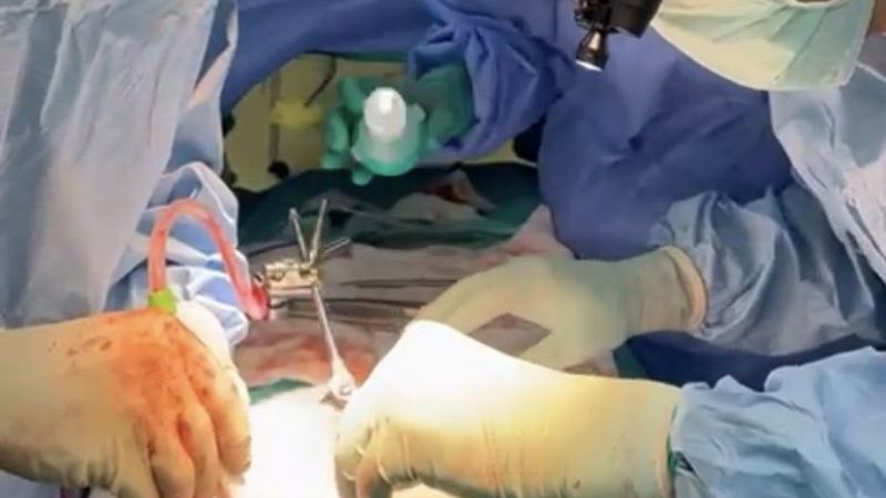 Oğlunun verdiği karaciğerle yaşama tutundu