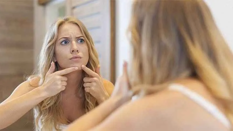 Sivilce sadece ergenlerin sorunu değil