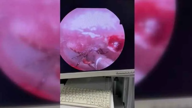 Kulağından kene çıktı!